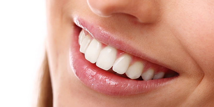Best teeth whitening options designed for people with tooth sensitivity.