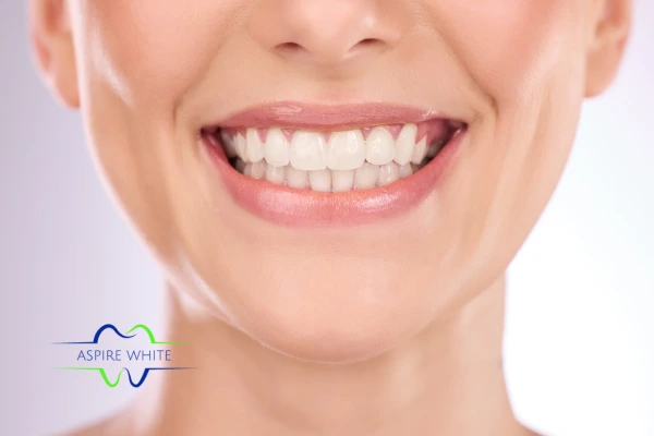 Follow your teeth whitening aftercare Wolverhampton to prolong your whiter smile!