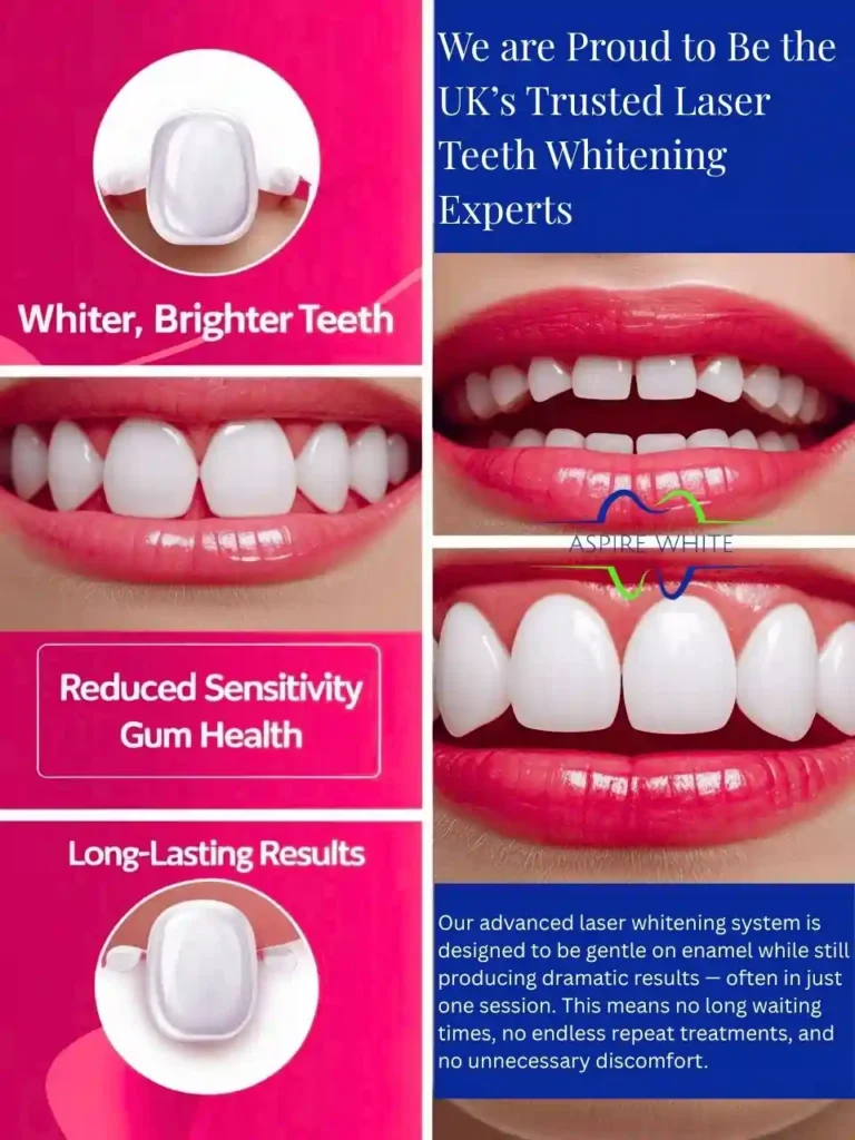 We are Proud to Be the UK’s Trusted Laser Teeth Whitening Experts Wolverhampton