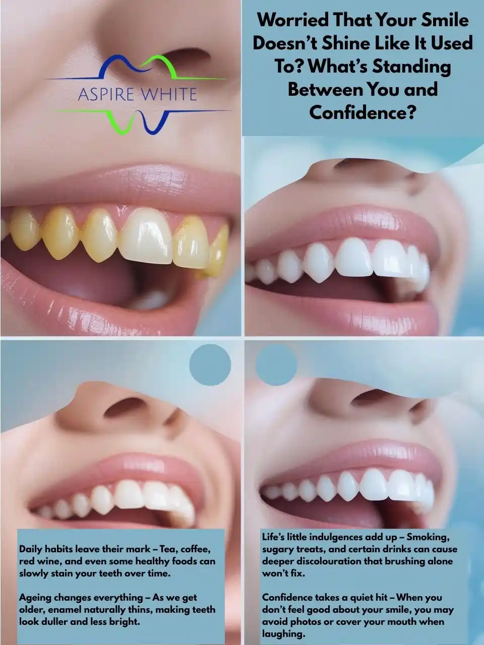 Worried That Your Smile Doesn’t Shine Like It Used To What’s Standing Between You and Confidence Wolverhampton